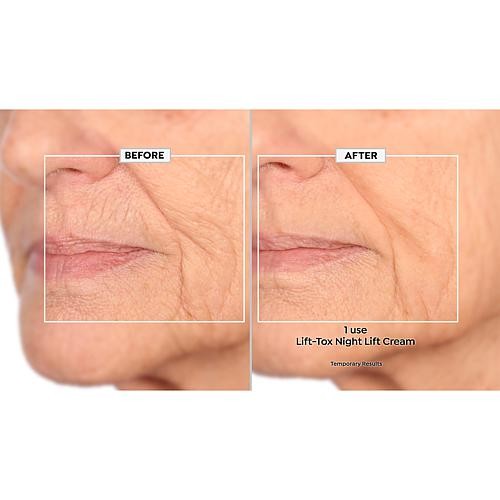 Nakery Beauty Lift-TOX NightLift Repair Cream